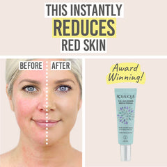 Rosalique 3 in 1 Anti Redness Miracle Formula before and after results
